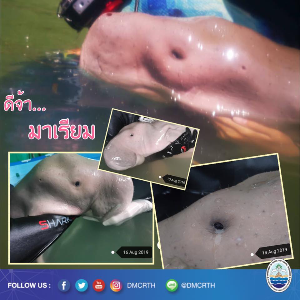 น้องมาเรียม ให้ความร่วมมือดี กินเยอะๆ แข็งแรงๆ สู้สู้